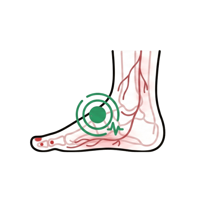 Flat feet